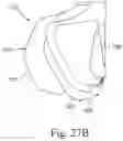 Fig. 24 - Cushion for a respiratory mask assembly