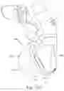 Fig. 25 - Cushion for a respiratory mask assembly