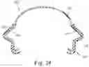 Fig. 28 - Cushion for a respiratory mask assembly
