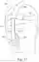 Fig. 36 - Cushion for a respiratory mask assembly