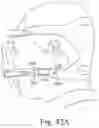 Fig. 40 - Cushion for a respiratory mask assembly