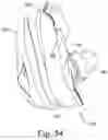 Fig. 50 - Cushion for a respiratory mask assembly