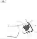 Fig. 05 - RESPIRATOR FACE MASK POSITIONING AND RETENTION DEVICE