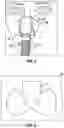 Fig. 03 - SYSTEM AND METHOD TO CREATE CUSTOM COLOR ADHESIVE SECUREMENT ARRANGEMENT