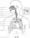 Fig. 05 - Respiratory pressure treatment system