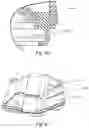 Fig. 100 - Respiratory pressure treatment system