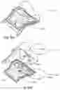 Fig. 101 - Respiratory pressure treatment system