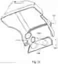 Fig. 106 - Respiratory pressure treatment system