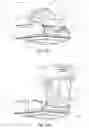 Fig. 111 - Respiratory pressure treatment system