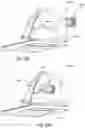 Fig. 115 - Respiratory pressure treatment system