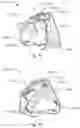 Fig. 19 - Respiratory pressure treatment system
