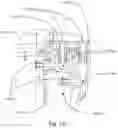 Fig. 34 - Respiratory pressure treatment system