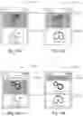 Fig. 39 - Respiratory pressure treatment system
