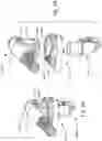 Fig. 65 - Respiratory pressure treatment system