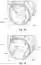 Fig. 66 - Respiratory pressure treatment system