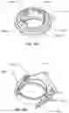 Fig. 72 - Respiratory pressure treatment system