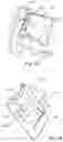 Fig. 91 - Respiratory pressure treatment system