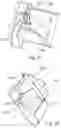Fig. 92 - Respiratory pressure treatment system