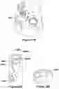 Fig. 21 - ADAPTORS AND USABILITY FEATURES FOR RESPIRATORY ASSISTANCE SYSTEMS