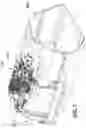 Fig. 20 - CPAP system