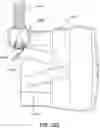 Fig. 59 - CPAP system