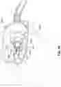 Fig. 88 - CPAP system