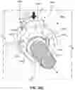 Fig. 54 - CPAP system
