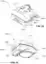 Fig. 114 - CPAP system