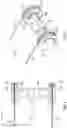 Fig. 04 - Steerable catheter