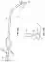 Fig. 11 - STYLET WITH IMPROVED THREADABILITY