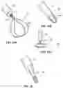 Fig. 12 - STYLET WITH IMPROVED THREADABILITY