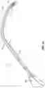 Fig. 13 - STYLET WITH IMPROVED THREADABILITY