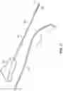 Fig. 14 - STYLET WITH IMPROVED THREADABILITY