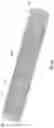 Fig. 03 - Method for preparing a steerable medical device with braided structure