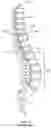 Fig. 03 - MEDICAL DELIVERY DEVICE AND METHOD FOR DELIVERING THERAPEUTIC AGENTS DIRECTLY INTO THE ANNULUS FIBROSUS OF AN INTERVERTEBRAL DISC