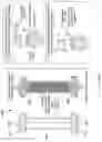 Fig. 04 - System and Method for Controlling CSF Flow and Managing Intracranial Pressure