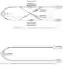 Fig. 09 - System and Method for Controlling CSF Flow and Managing Intracranial Pressure