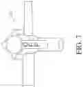 Fig. 11 - INTRAGASTRIC DEVICE