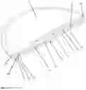Fig. 13 - Implant for local active ingredient release