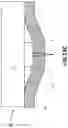 Fig. 20 - Practice-loadable minimally invasive allergy test system