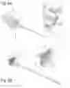 Fig. 09 - FRICTIONAL TRANS-EPITHELIAL TISSUE DISRUPTION COLLECTION APPARATUS AND METHOD OF INDUCING AN IMMUNE RESPONSE