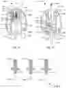 Fig. 02 - Medical device with actuation mechanism