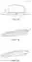 Fig. 11 - IMPLANTABLE MEDICAL DEVICE FOR IMPROVED PLACEMENT AND ADHERENCE IN THE BODY