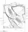 Fig. 05 - Intravascular blood pumps and methods of use and manufacture