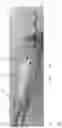 Fig. 06 - Intravascular blood pumps and methods of use and manufacture