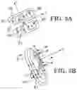 Fig. 04 - Method and apparatus for cancer treatment