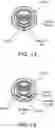 Fig. 06 - ANATOMICAL/PHYSIOLOGICAL EVENT APPARATUS AND METHOD OF TREATING AN APPROACHING