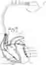 Fig. 01 - METHOD AND SYSTEM FOR BIVENTRICULAR OR LEFT VENTRICULAR PACING