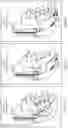 Fig. 04 - METHOD AND SYSTEM FOR BIVENTRICULAR OR LEFT VENTRICULAR PACING