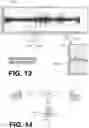 Fig. 12 - WEARABLE CARDIOVERTER DEFIBRILLATOR (WCD) SYSTEM SELECTING PREVIOUSLY IDENTIFIED PREFERRED CHANNEL FOR ATTEMPTING TO DETECT PACING ARTIFACTS